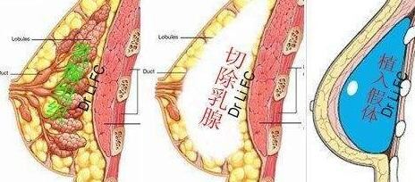 刘志兵