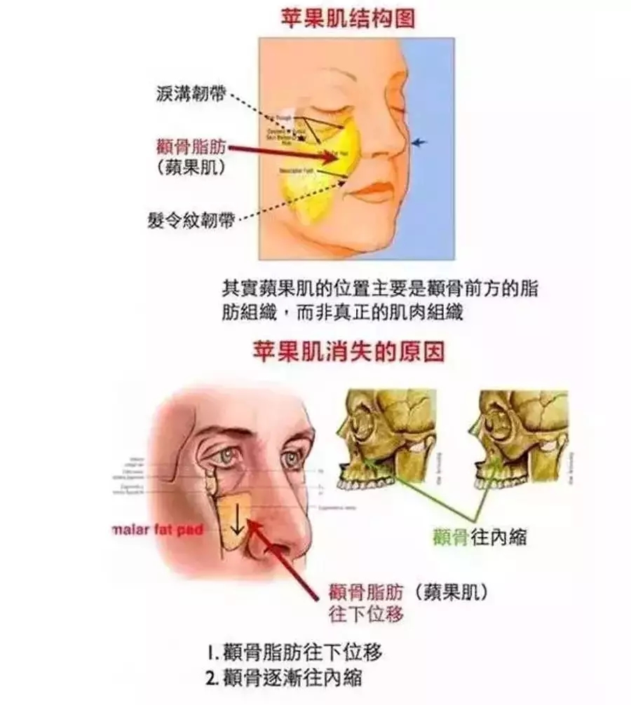 苹果肌嘭嘭不下垂，苍老倦容不再有！