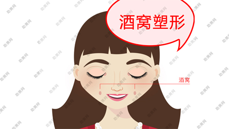 酒窝整形手术的费用需要多少钱