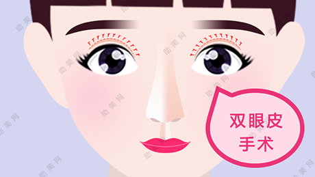 珠海六和整形割双眼皮多少钱