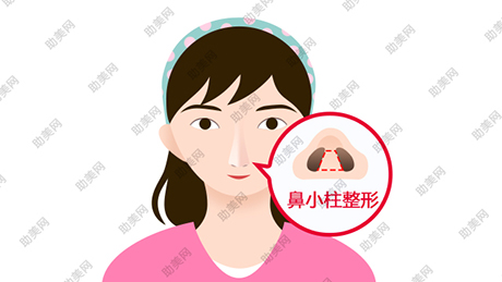 莞城唯美鼻小柱整形材料是啥