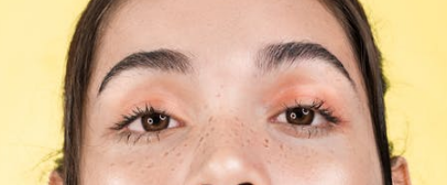 去眼袋手术什么时候做效果好