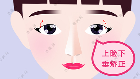 上睑下垂矫正有怎样的过程
